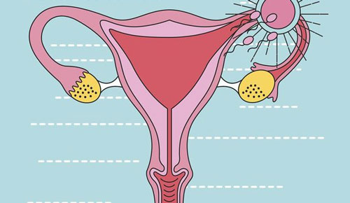 多囊卵巢做试管成功率高吗？影响因素有很多！