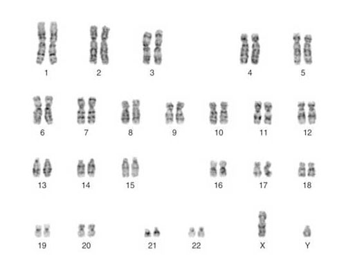 备孕染色体筛查主要查什么？确认是否存在基因问题！