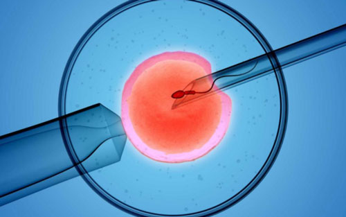 两侧输卵管切除可以做试管婴儿吗？卵巢功能正常就行！