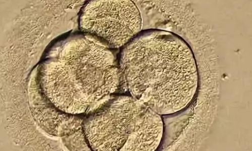 试管放一个胚胎好还是两个好?试管婴儿移植一个还是两个好?